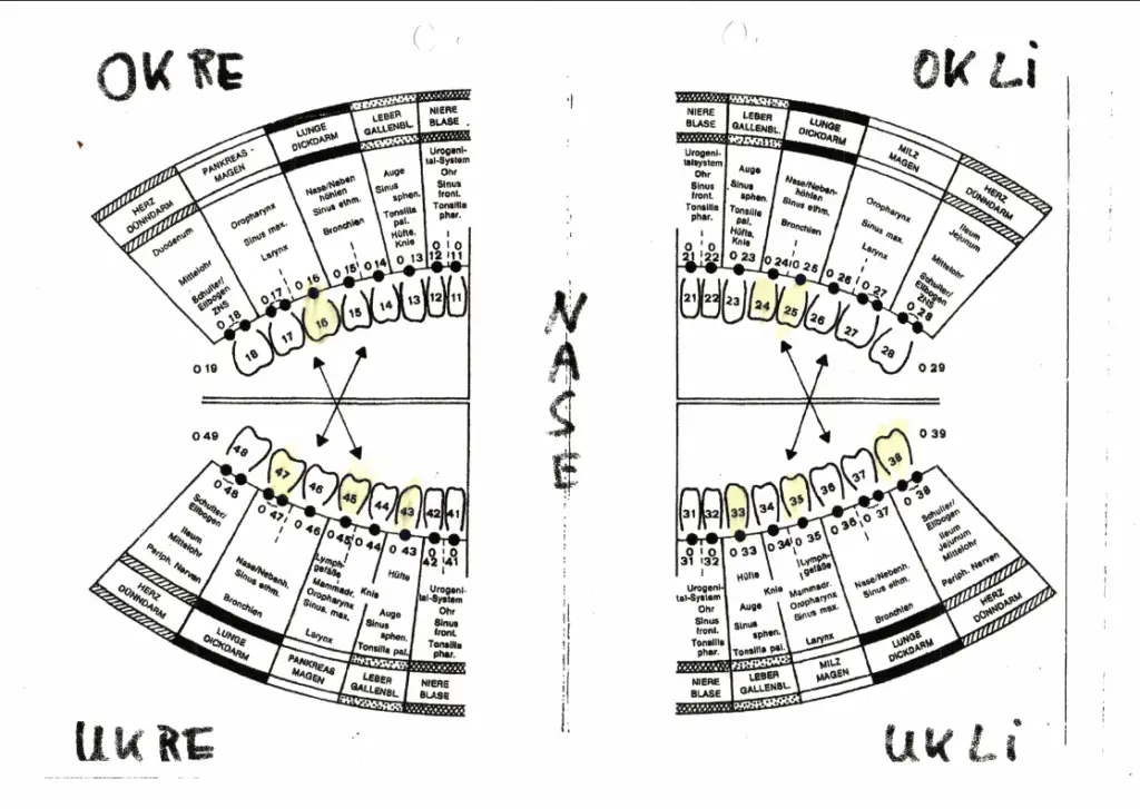 Reflexzonendiagramm